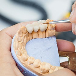 dentist polishing dental bridge